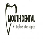 Full Mouth Dental Implants