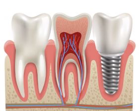 Happy Dental Health Care, Elevating Oral Care in Vijayawada