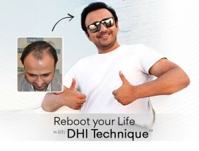  DHI India - Best Hair Transplant in Delhi