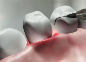 Dentist in Navi Mumbai