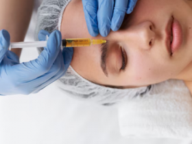 PRP Treatment in Lucknow for Face