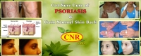 CNR HERBS | Psoriasis Hospital