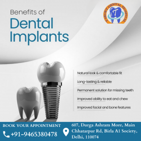 Dental Implants 