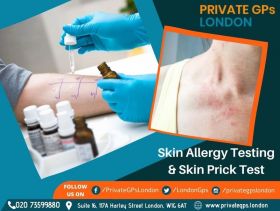 Skin Allergy Testing and Skin Prick Test