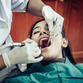 ­ROOT CANAL TREATMENT