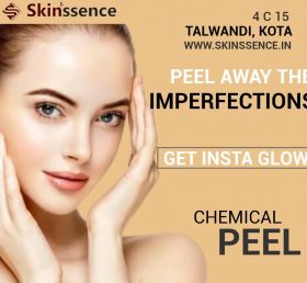 Chemical Peel