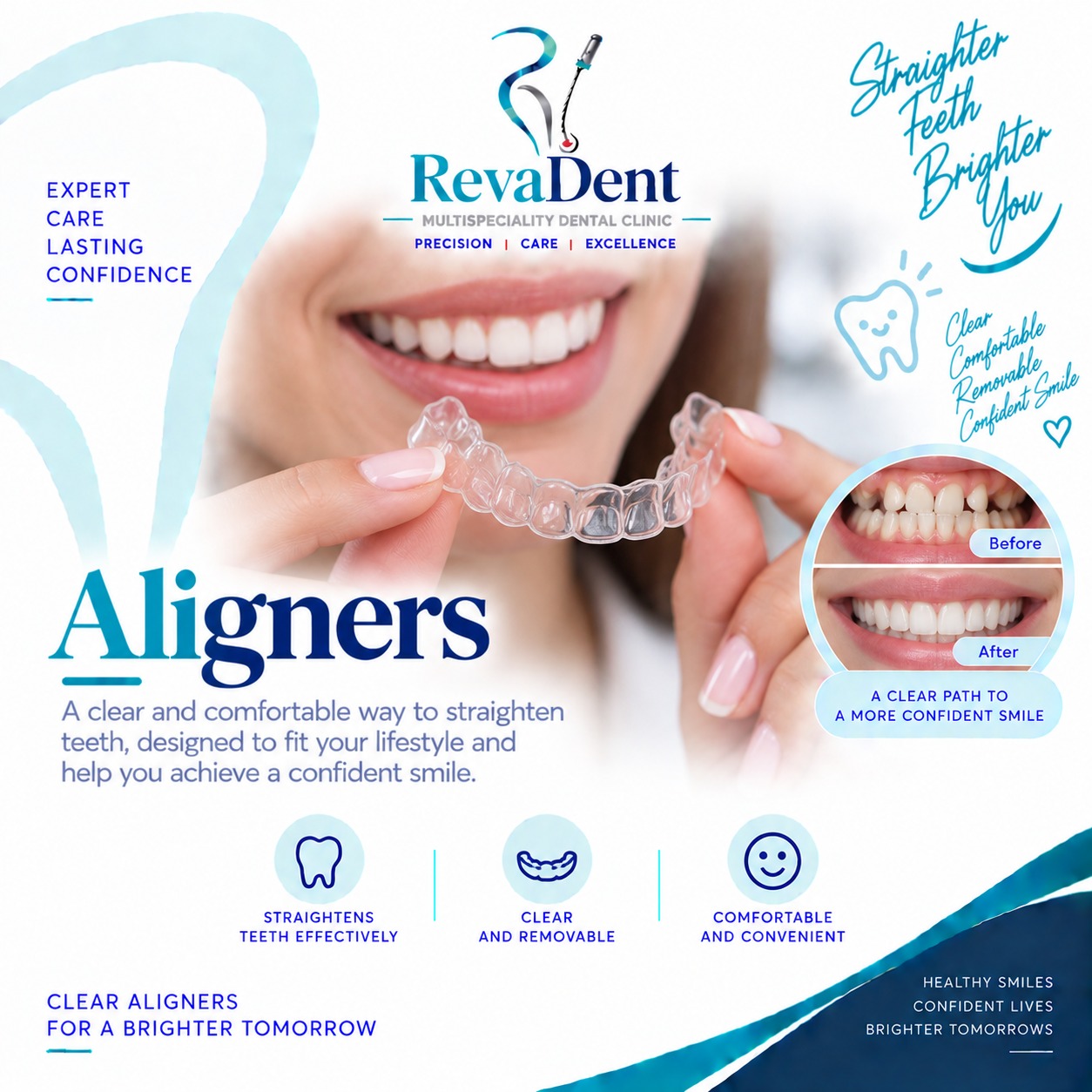 Clear Aligners