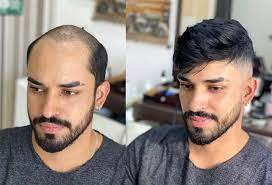 Affordable Hair Pieces for Men for a Natural Look