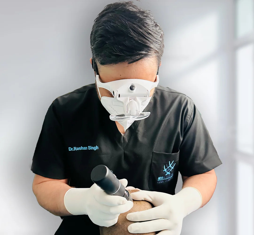 Looking for the Best Hair Transplant in Lucknow?